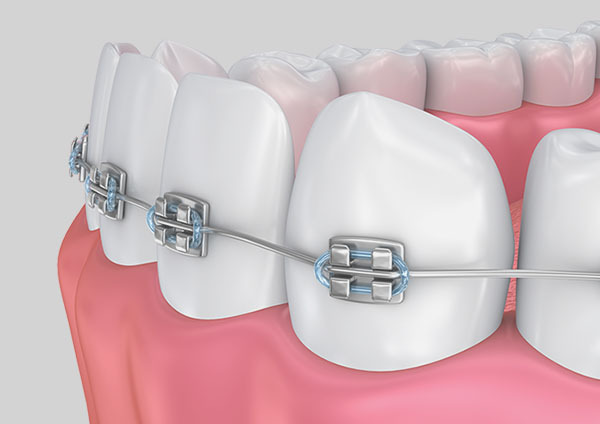 Orthodontics